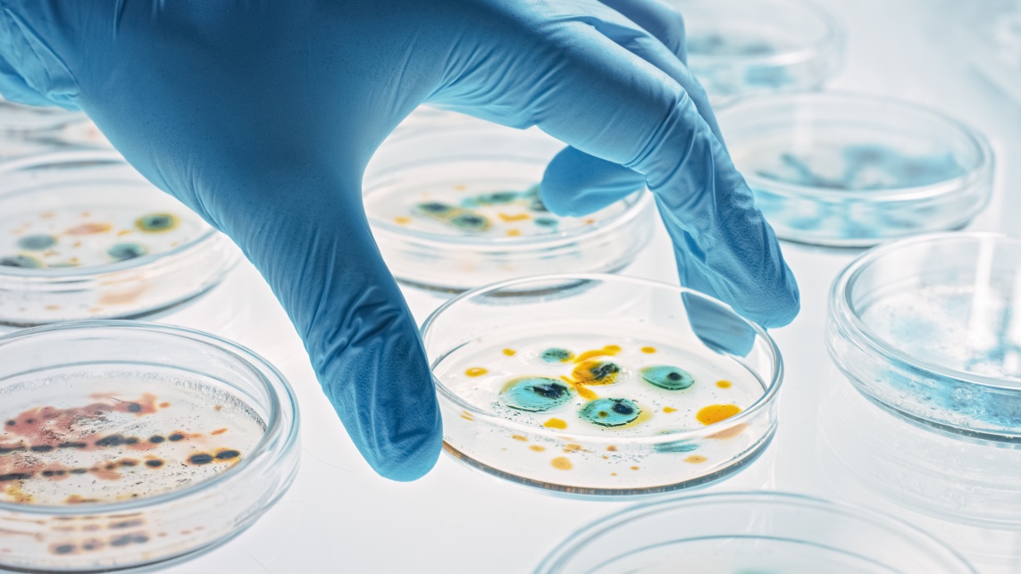 Scientist Works with Petri Dishes with Various Bacteria, Tissue and Blood Samples. Concept of Pharmaceutical Research for Antibiotics, Curing Disease with DNA Enhancing Drugs. Moving Close-up Macro